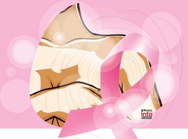 breast.jpg