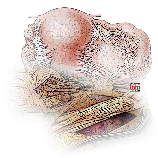 fascia.jpg