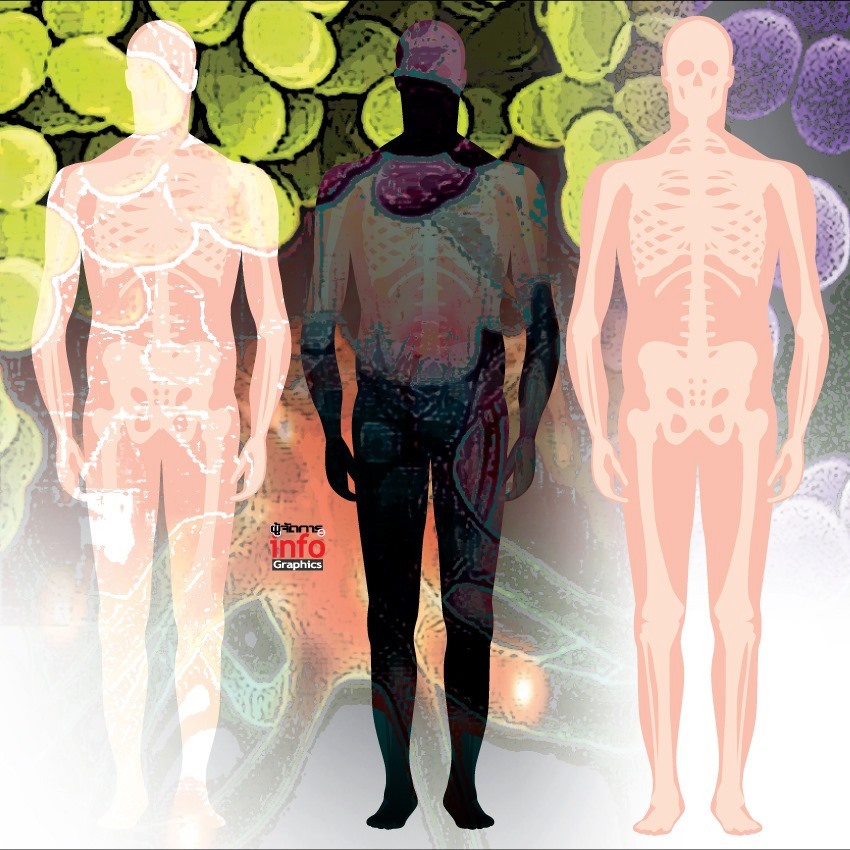 staphbacteria.jpg