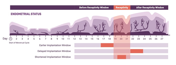 WOI-Infographic.jpg